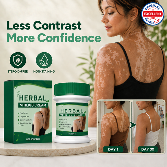 Herbal Vitiligo Cream